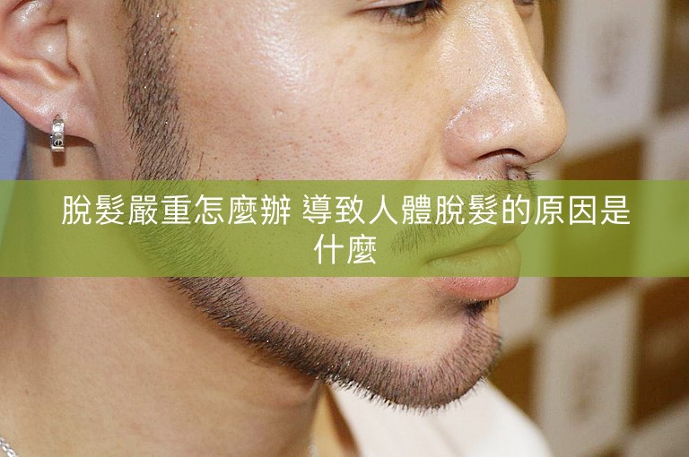 脫髮嚴重怎麼辦 導致人體脫髮的原因是什麼 脫髮嚴重怎麼辦 導致人體脫髮的原因是什麼