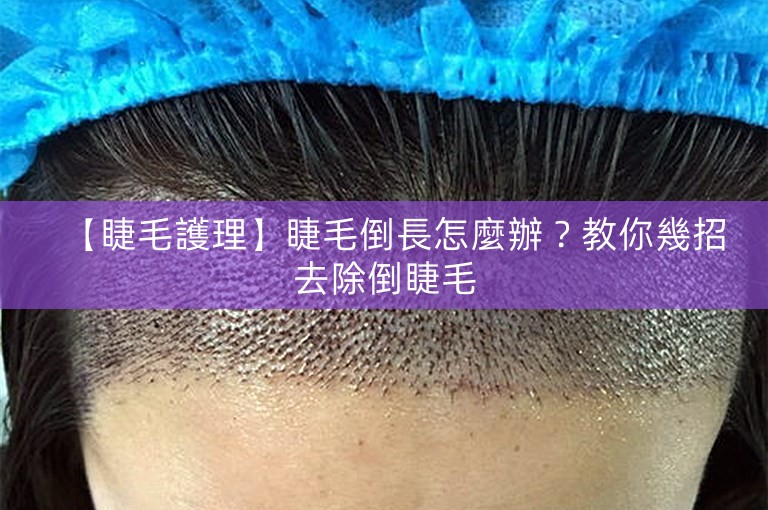 【睫毛護理】睫毛倒長怎麼辦?教你幾招去除倒睫毛 【睫毛護理】睫毛倒長怎麼辦?教你幾招去除倒睫毛