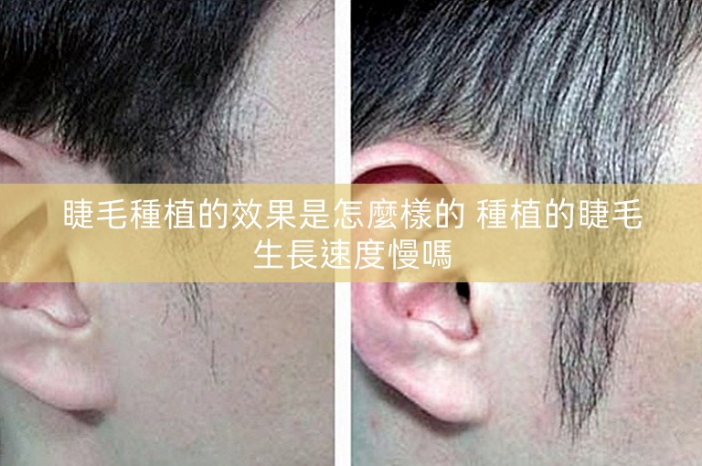 睫毛種植的效果是怎麼樣的 種植的睫毛生長速度慢嗎 睫毛種植的效果是怎麼樣的 種植的睫毛生長速度慢嗎