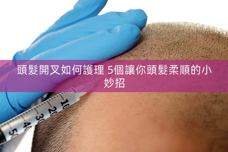 頭髮開叉如何護理 5個讓你頭髮柔順的小妙招 頭髮開叉如何護理 5個讓你頭髮柔順的小妙招