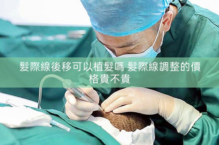髮際線後移可以植髮嗎 髮際線調整的價格貴不貴