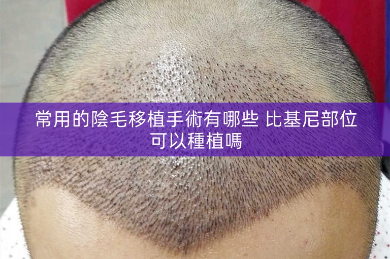 常用的陰毛移植手術有哪些 比基尼部位可以種植嗎