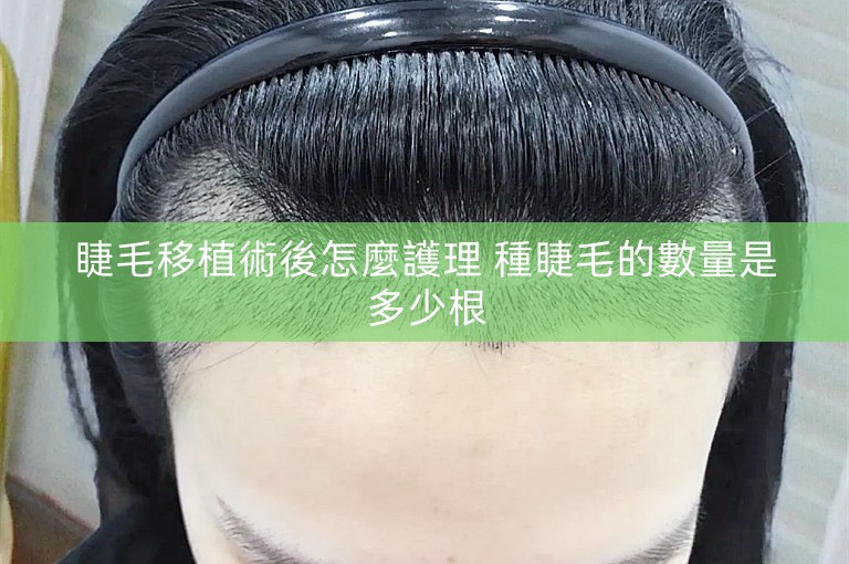 睫毛移植術後怎麼護理 種睫毛的數量是多少根
