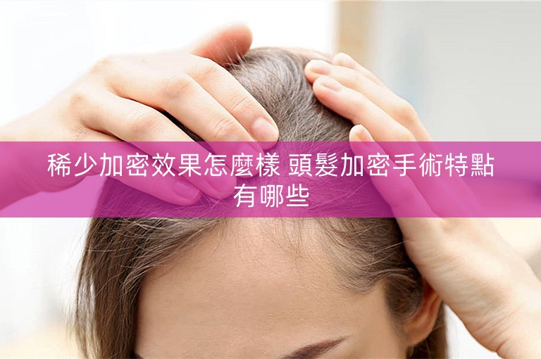 稀少加密效果怎麼樣 頭髮加密手術特點有哪些 稀少加密效果怎麼樣 頭髮加密手術特點有哪些