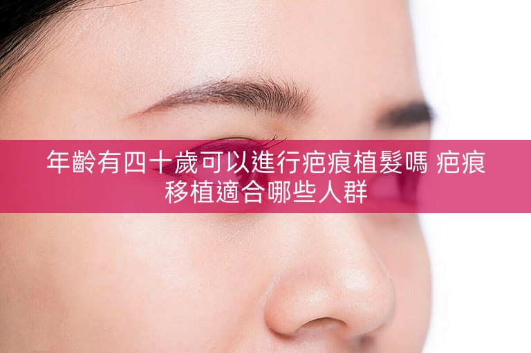 年齡有四十歲可以進行疤痕植髮嗎 疤痕移植適合哪些人群