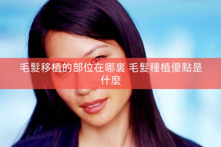毛髮移植的部位在哪裏 毛髮種植優點是什麼