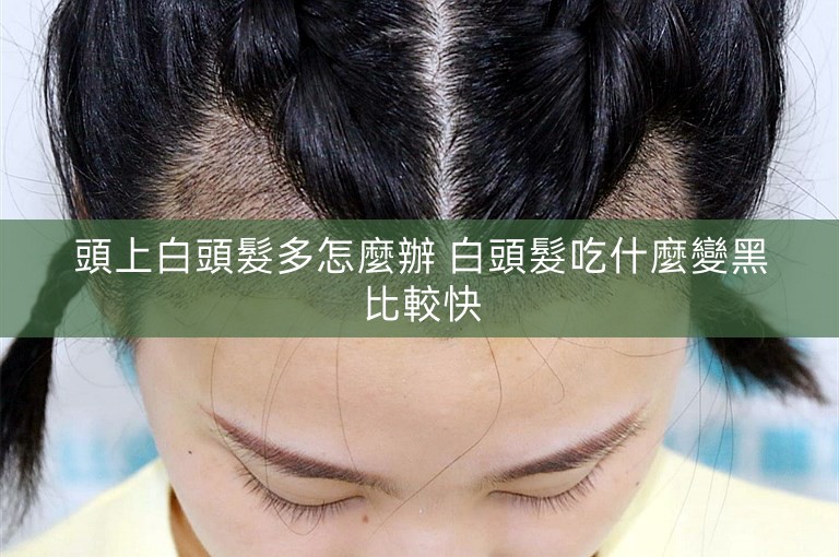 頭上白頭髮多怎麼辦 白頭髮吃什麼變黑比較快 頭上白頭髮多怎麼辦 白頭髮吃什麼變黑比較快