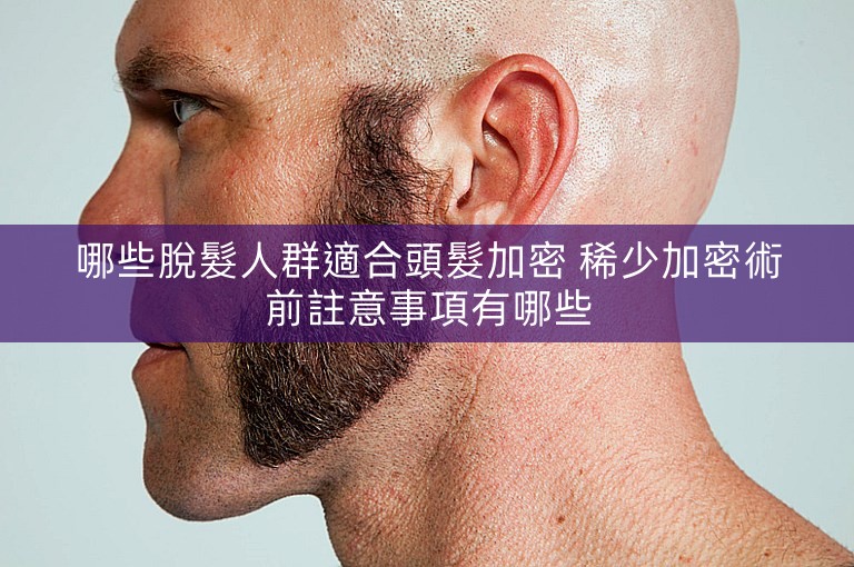 哪些脫髮人群適合頭髮加密 稀少加密術前註意事項有哪些
