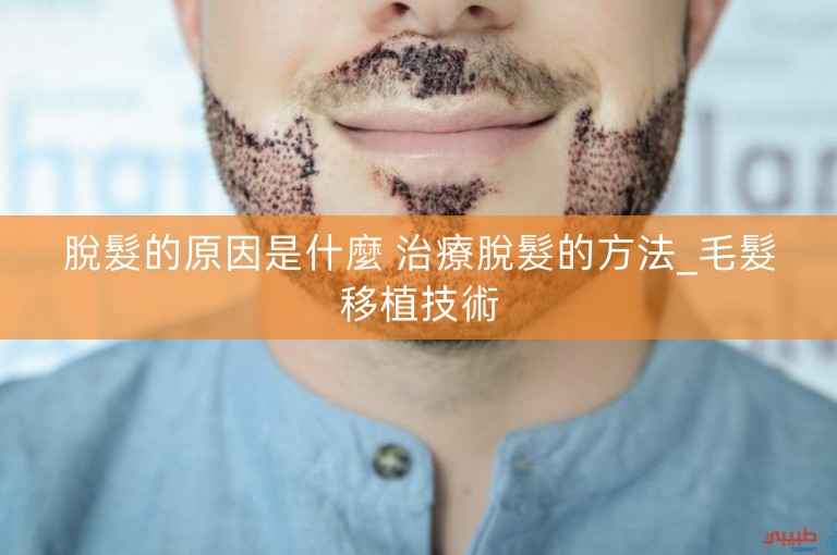 脫髮的原因是什麼 治療脫髮的方法_毛髮移植技術