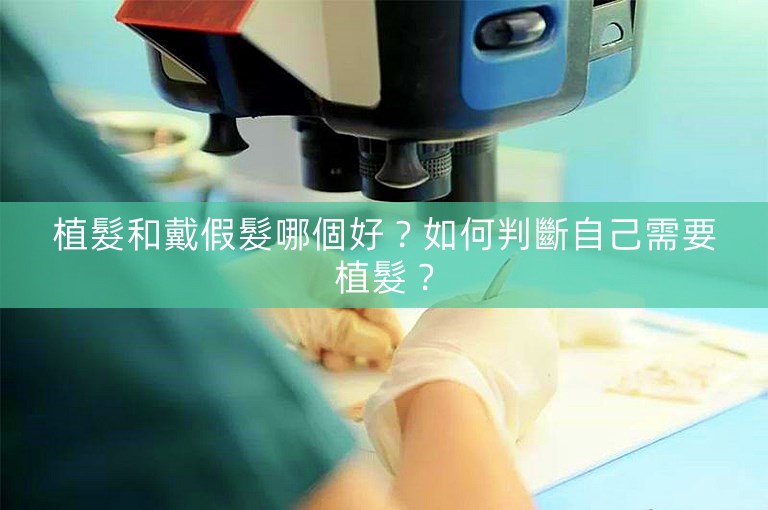 植髮和戴假髮哪個好?如何判斷自己需要植髮? 植髮和戴假髮哪個好?如何判斷自己需要植髮?