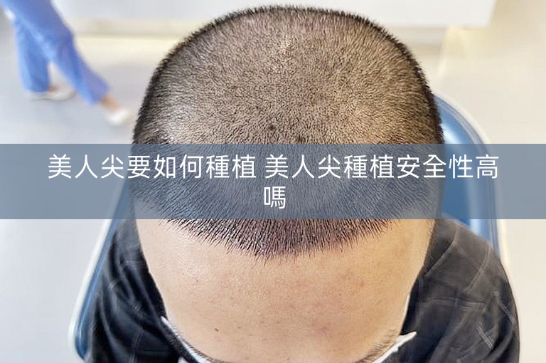 美人尖要如何種植 美人尖種植安全性高嗎