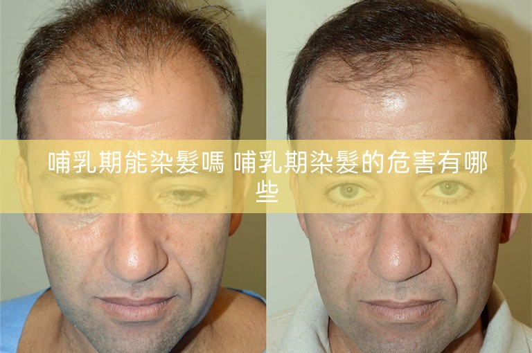 哺乳期能染髮嗎 哺乳期染髮的危害有哪些