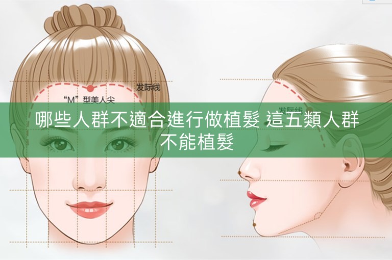 哪些人群不適合進行做植髮 這五類人群不能植髮