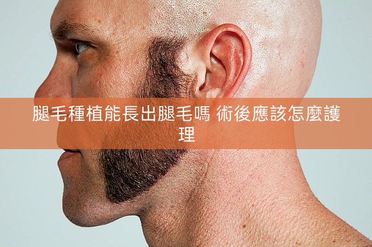 腿毛種植能長出腿毛嗎 術後應該怎麼護理 腿毛種植能長出腿毛嗎 術後應該怎麼護理