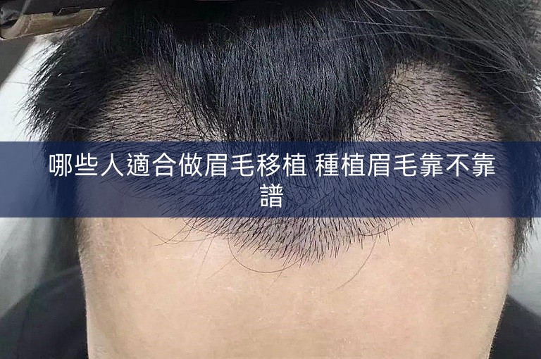 哪些人適合做眉毛移植 種植眉毛靠不靠譜