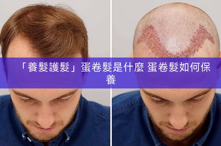「養髮護髮」蛋卷髮是什麼 蛋卷髮如何保養