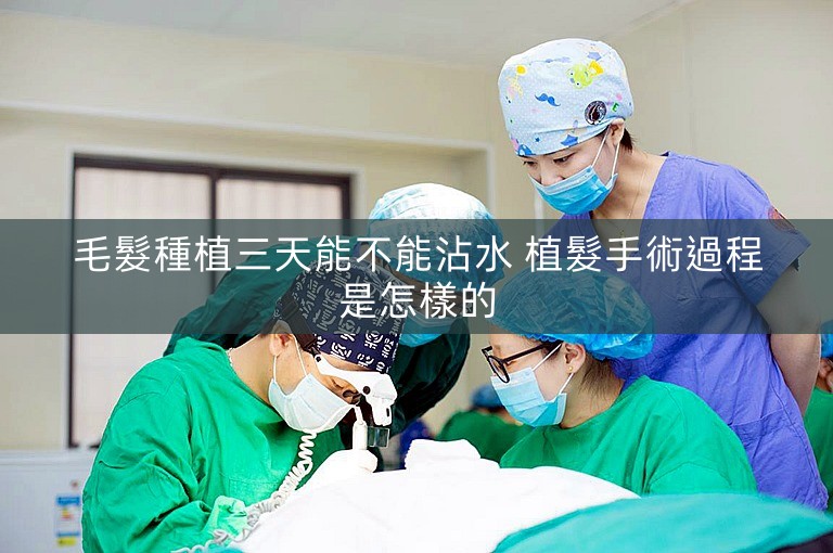 毛髮種植三天能不能沾水 植髮手術過程是怎樣的