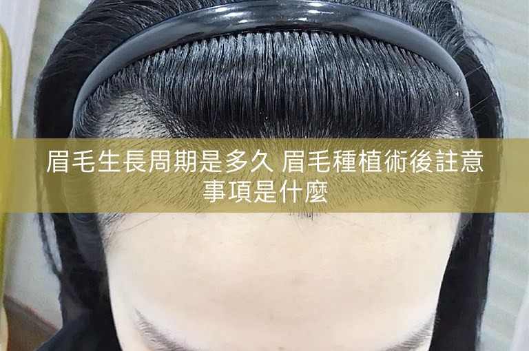 眉毛生長周期是多久 眉毛種植術後註意事項是什麼