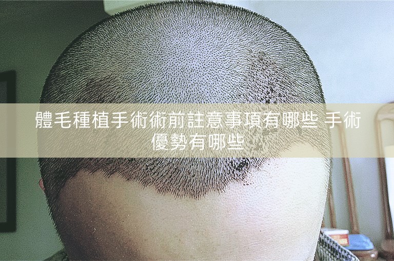 體毛種植手術術前註意事項有哪些 手術優勢有哪些