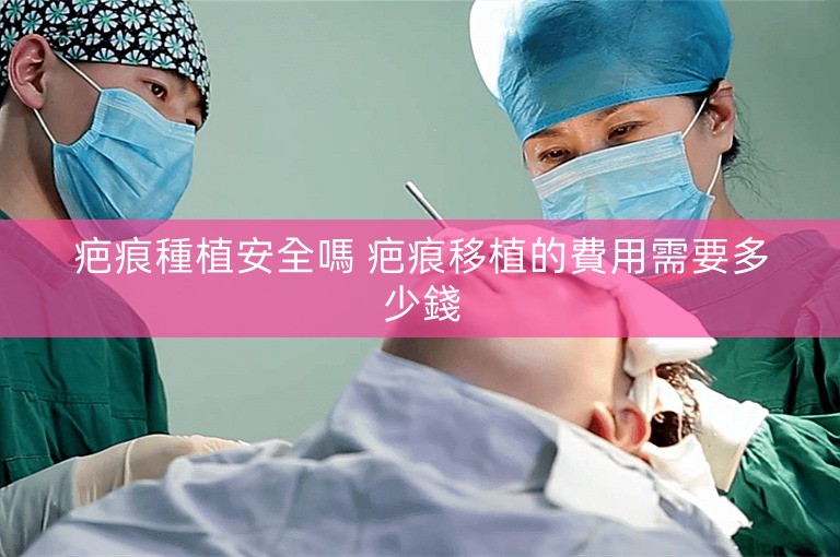 疤痕種植安全嗎 疤痕移植的費用需要多少錢
