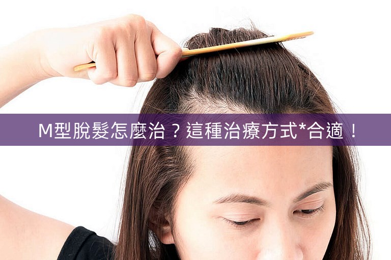 M型脫髮怎麼治？這種治療方式*合適！