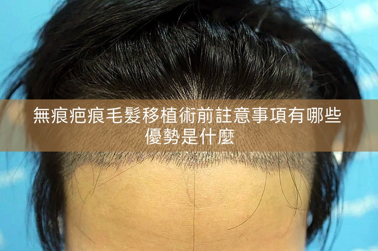無痕疤痕毛髮移植術前註意事項有哪些 優勢是什麼 無痕疤痕毛髮移植術前註意事項有哪些 優勢是什麼