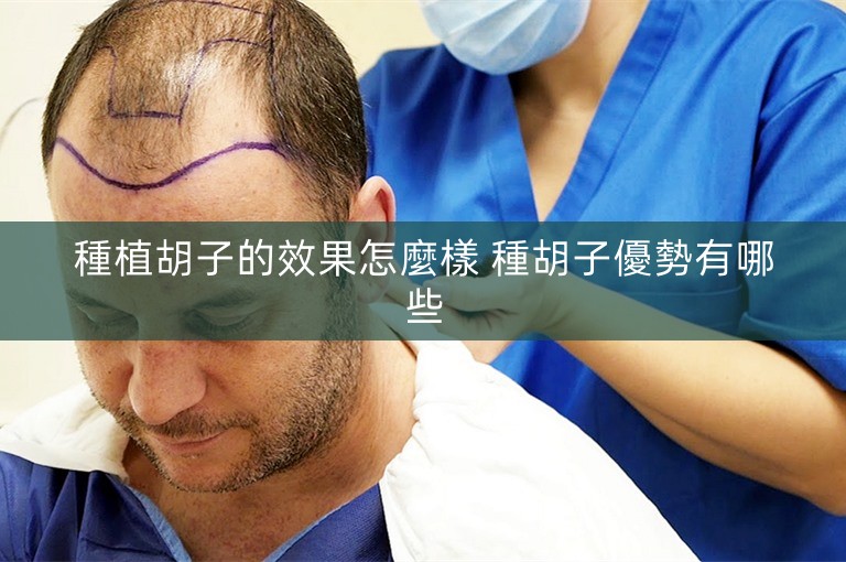 種植胡子的效果怎麼樣 種胡子優勢有哪些 種植胡子的效果怎麼樣 種胡子優勢有哪些