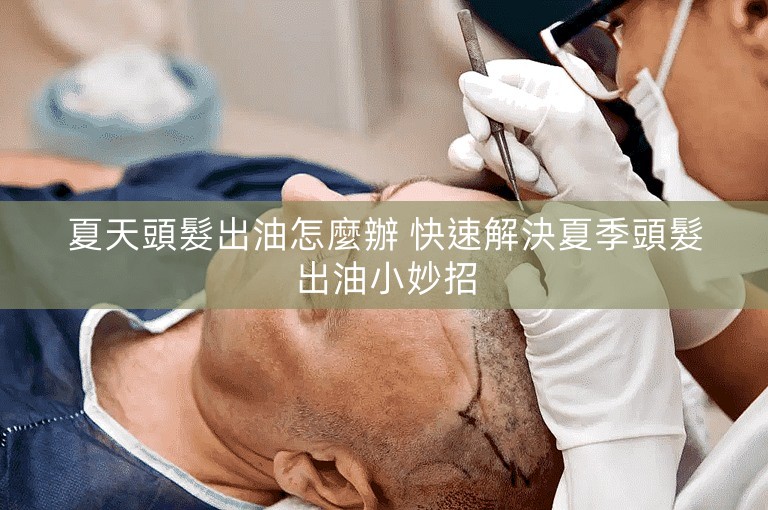 夏天頭髮出油怎麼辦 快速解決夏季頭髮出油小妙招