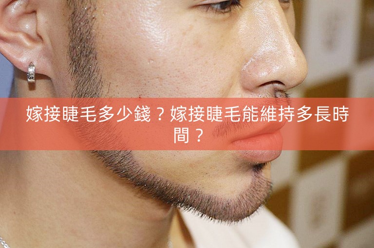 嫁接睫毛多少錢?嫁接睫毛能維持多長時間? 嫁接睫毛多少錢?嫁接睫毛能維持多長時間?