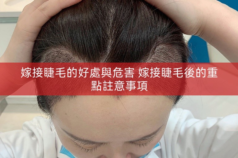 嫁接睫毛的好處與危害 嫁接睫毛後的重點註意事項