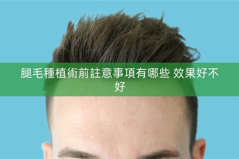 腿毛種植術前註意事項有哪些 效果好不好 腿毛種植術前註意事項有哪些 效果好不好