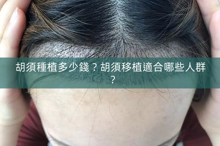 胡須種植多少錢?胡須移植適合哪些人群? 胡須種植多少錢?胡須移植適合哪些人群?