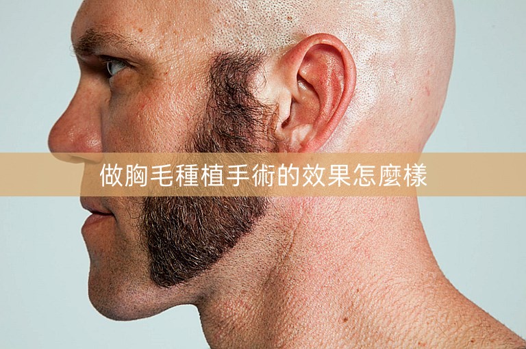 做胸毛種植手術的效果怎麼樣 做胸毛種植手術的效果怎麼樣