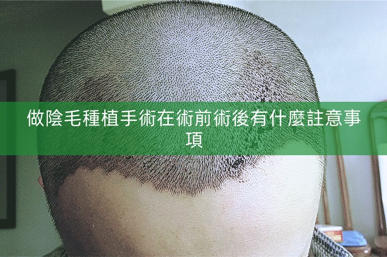 做陰毛種植手術在術前術後有什麼註意事項