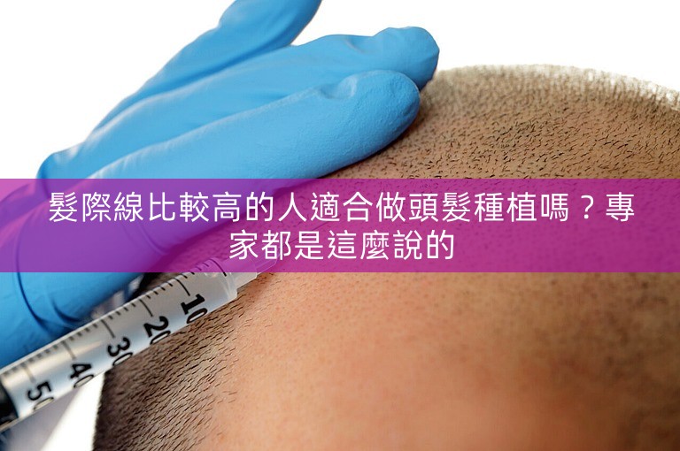 髮際線比較高的人適合做頭髮種植嗎？專家都是這麼說的