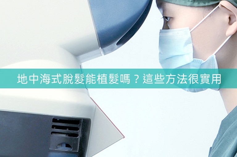 地中海式脫髮能植髮嗎？這些方法很實用