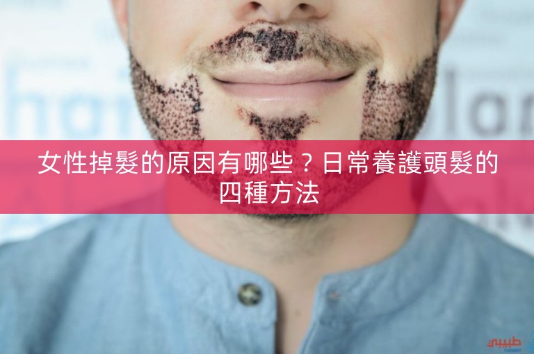 女性掉髮的原因有哪些？日常養護頭髮的四種方法