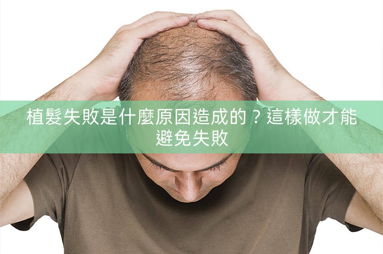 植髮失敗是什麼原因造成的？這樣做才能避免失敗