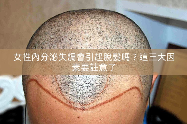 女性內分泌失調會引起脫髮嗎?這三大因素要註意了 女性內分泌失調會引起脫髮嗎?這三大因素要註意了