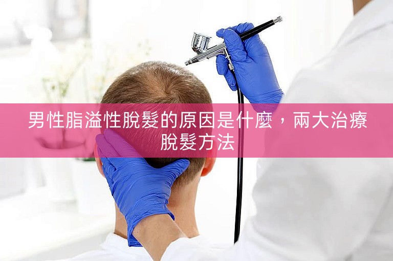 男性脂溢性脫髮的原因是什麼，兩大治療脫髮方法