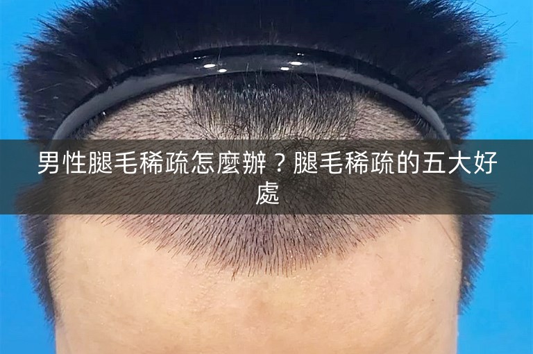 男性腿毛稀疏怎麼辦?腿毛稀疏的五大好處 男性腿毛稀疏怎麼辦?腿毛稀疏的五大好處