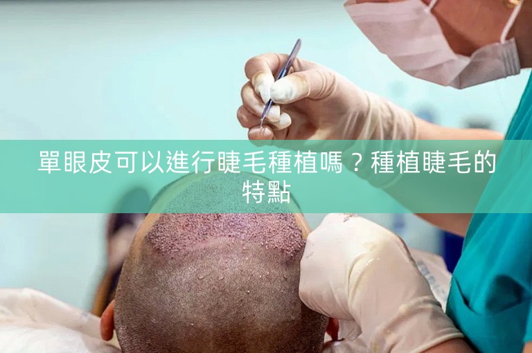 單眼皮可以進行睫毛種植嗎？種植睫毛的特點
