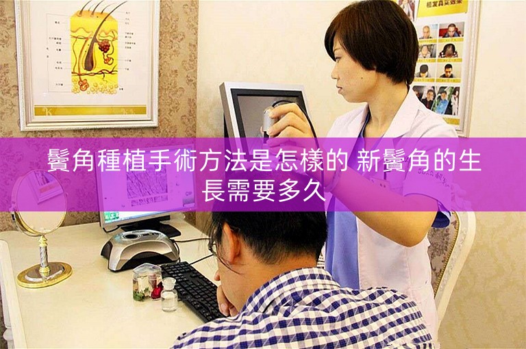 鬢角種植手術方法是怎樣的 新鬢角的生長需要多久
