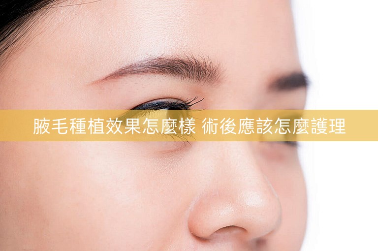 腋毛種植效果怎麼樣 術後應該怎麼護理