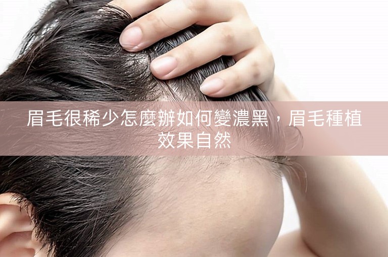 眉毛很稀少怎麼辦如何變濃黑，眉毛種植效果自然