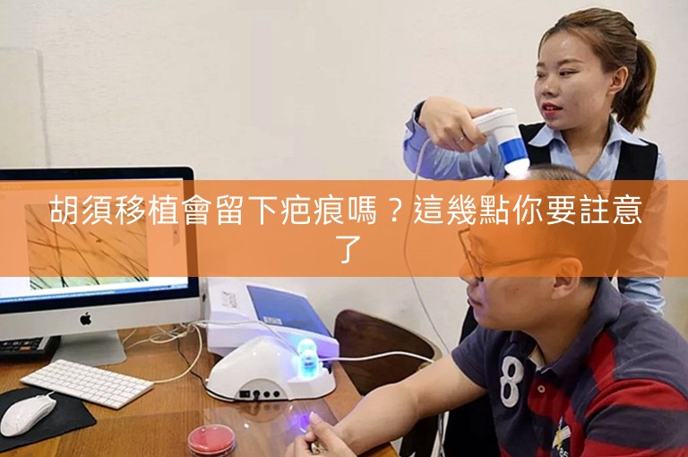 胡須移植會留下疤痕嗎？這幾點你要註意了