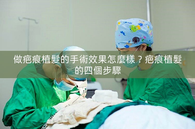 做疤痕植髮的手術效果怎麼樣？疤痕植髮的四個步驟
