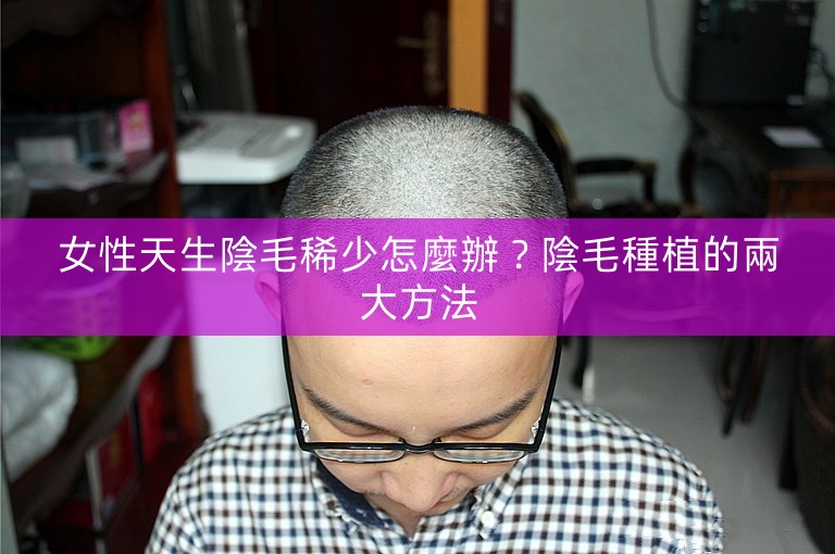 女性天生陰毛稀少怎麼辦?陰毛種植的兩大方法 女性天生陰毛稀少怎麼辦?陰毛種植的兩大方法