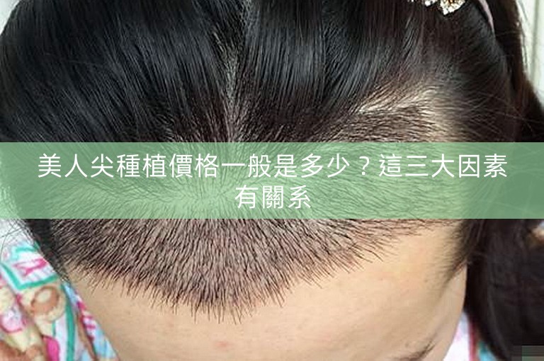 美人尖種植價格一般是多少？這三大因素有關系