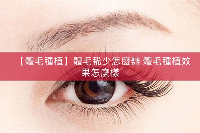 【體毛種植】體毛稀少怎麼辦 體毛種植效果怎麼樣